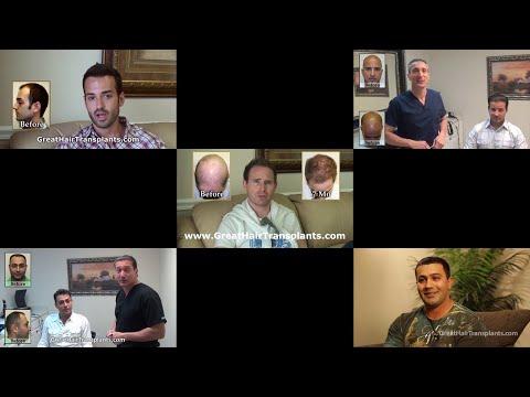 Hair Transplant Videos