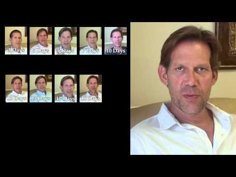 Hair Transplant Videos