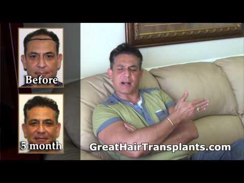 Hair Transplant Video