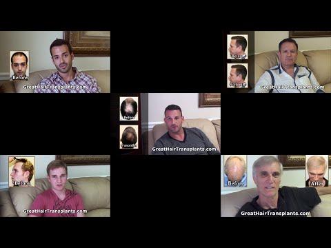 Hair Transplant Videos