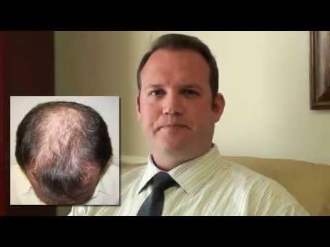 Hair Transplant Videos