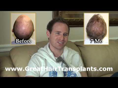 Hair Transplant Video