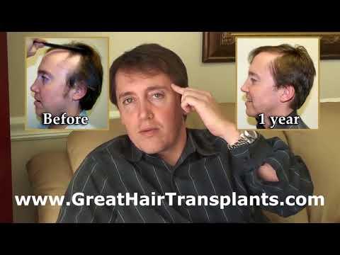 Hair Transplant Video