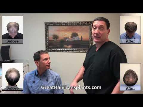 Hair Transplant Videos