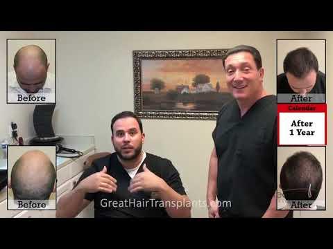 Hair Transplant Video
