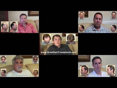 Hair Transplant Videos