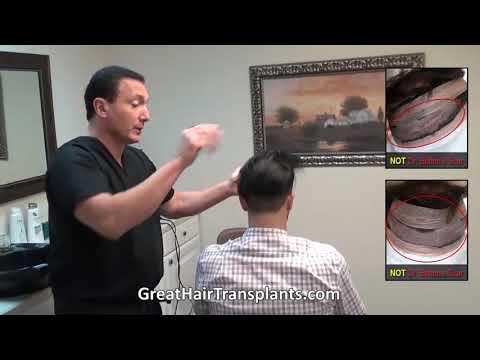 Hair Transplant Videos