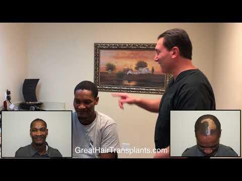 Hair Transplant Video