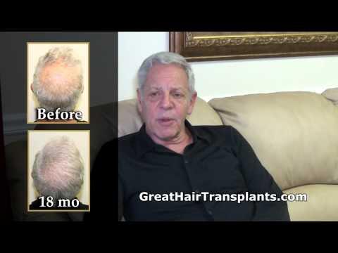 Hair Transplant Videos