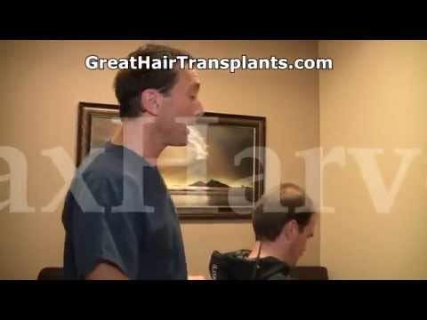 Hair Transplant Video