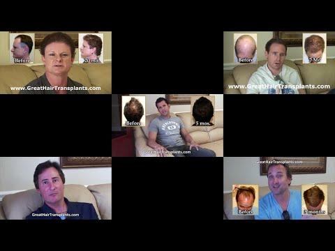 Hair Transplant Videos