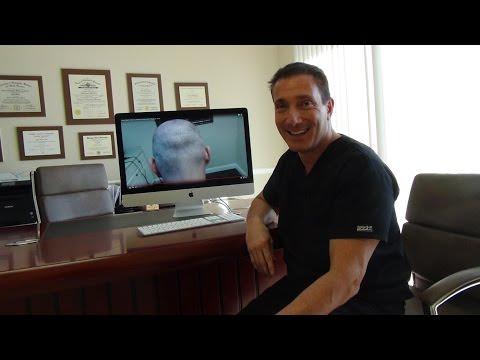 Hair Transplant Video