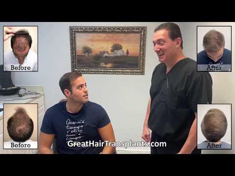 Hair Transplant Videos