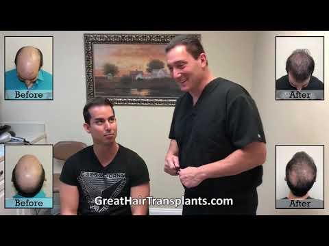 Hair Transplant Videos