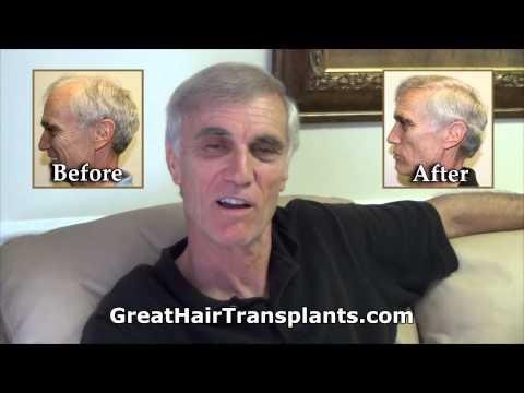 Hair Transplant Video