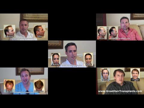 Hair Transplant Videos