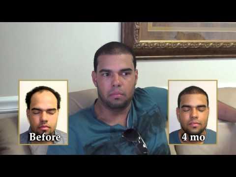 Hair Transplant Video