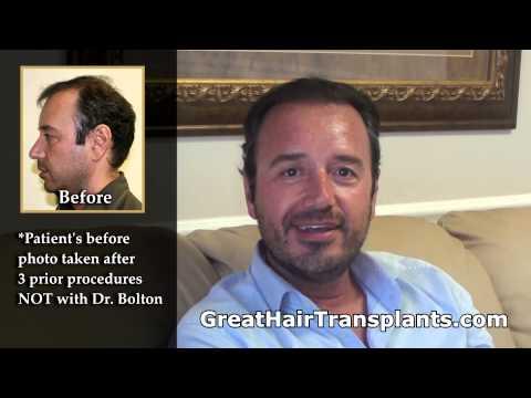 Hair Transplant Video