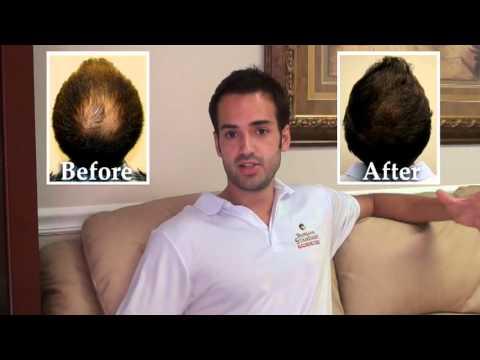 Hair Transplant Videos