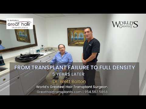 Hair Transplant Video