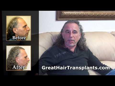 Hair Transplant Video