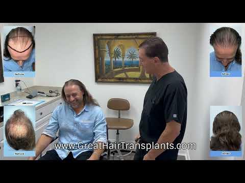 Hair Transplant Video