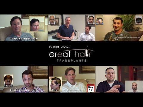 Hair Transplant Videos