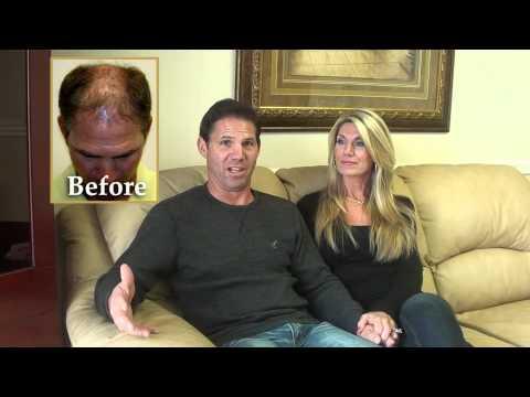 Hair Transplant Video