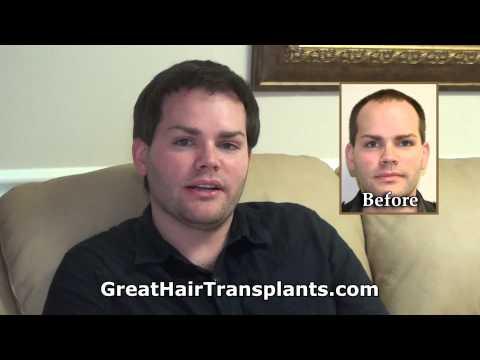 Hair Transplant Videos