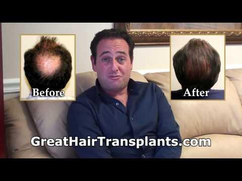 Hair Transplant Video