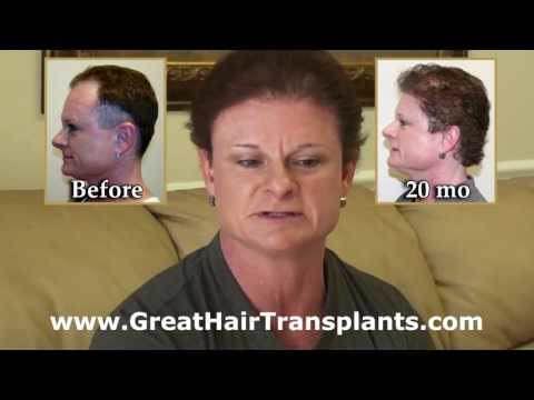 Hair Transplant Videos