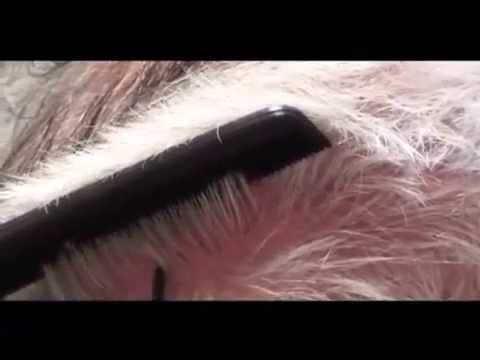 Hair Transplant Video