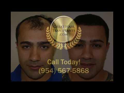 Hair Transplant Videos