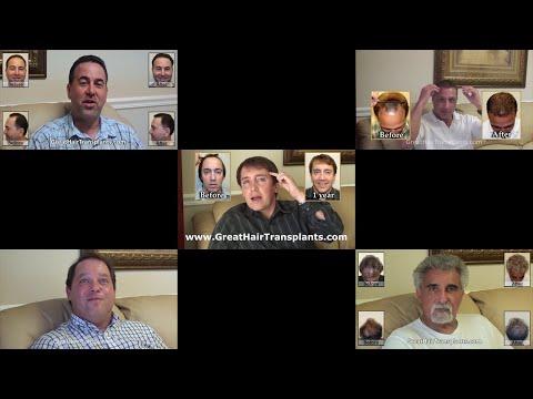 Hair Transplant Videos