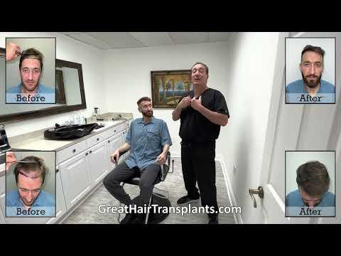 Hair Transplant Videos