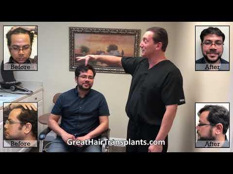 Hair Transplant Videos