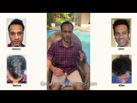 Hair Transplant Video