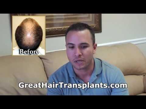 Hair Transplant Video