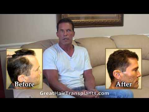 Hair Transplant Videos