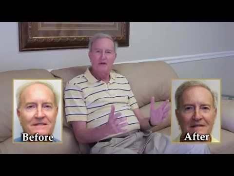 Hair Transplant Videos