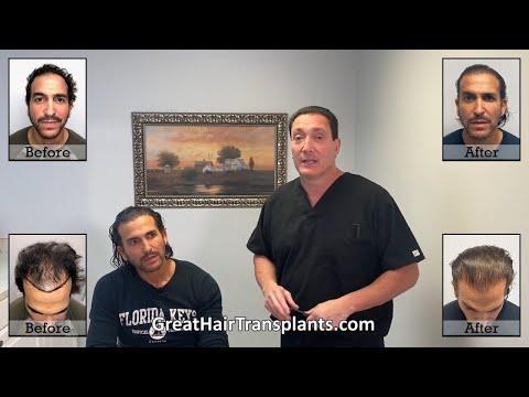 Hair Transplant Videos