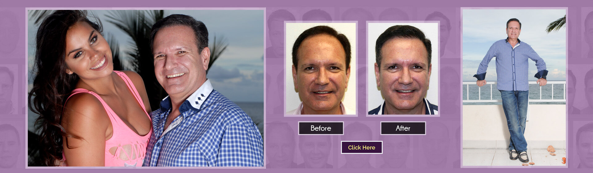 fue before and after pictures