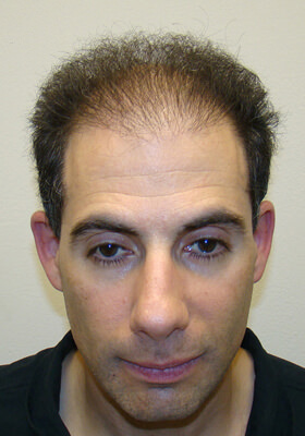 Dr Brett Bolton Patient Photos  - One Procedures