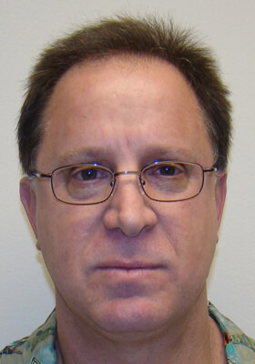 Dr Brett Bolton Patient Photos  - One Procedure