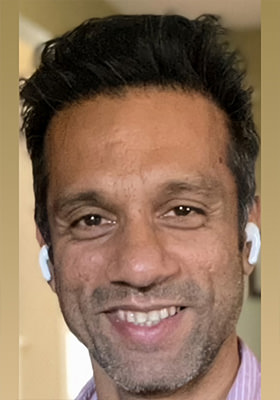 hair transplant photos