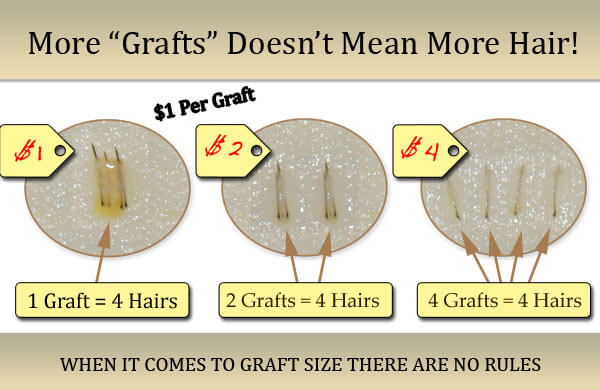 Hair Graft