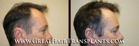 hair procedures